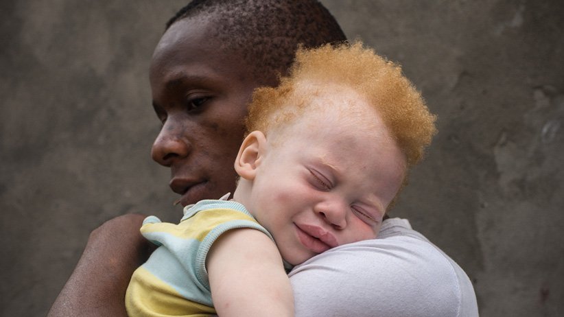 09 Jul 2013, Kinshasa, Democratic Republic of the Congo --- Democratic Republic of Congo (DRC), Kinshasa, black father holding his albino todler (Shango Okaka) in his smiling albino toddler in his arms against a grey wall, Kinshasa, (MR) Patricia Willocq/Art in All of Us/Corbis